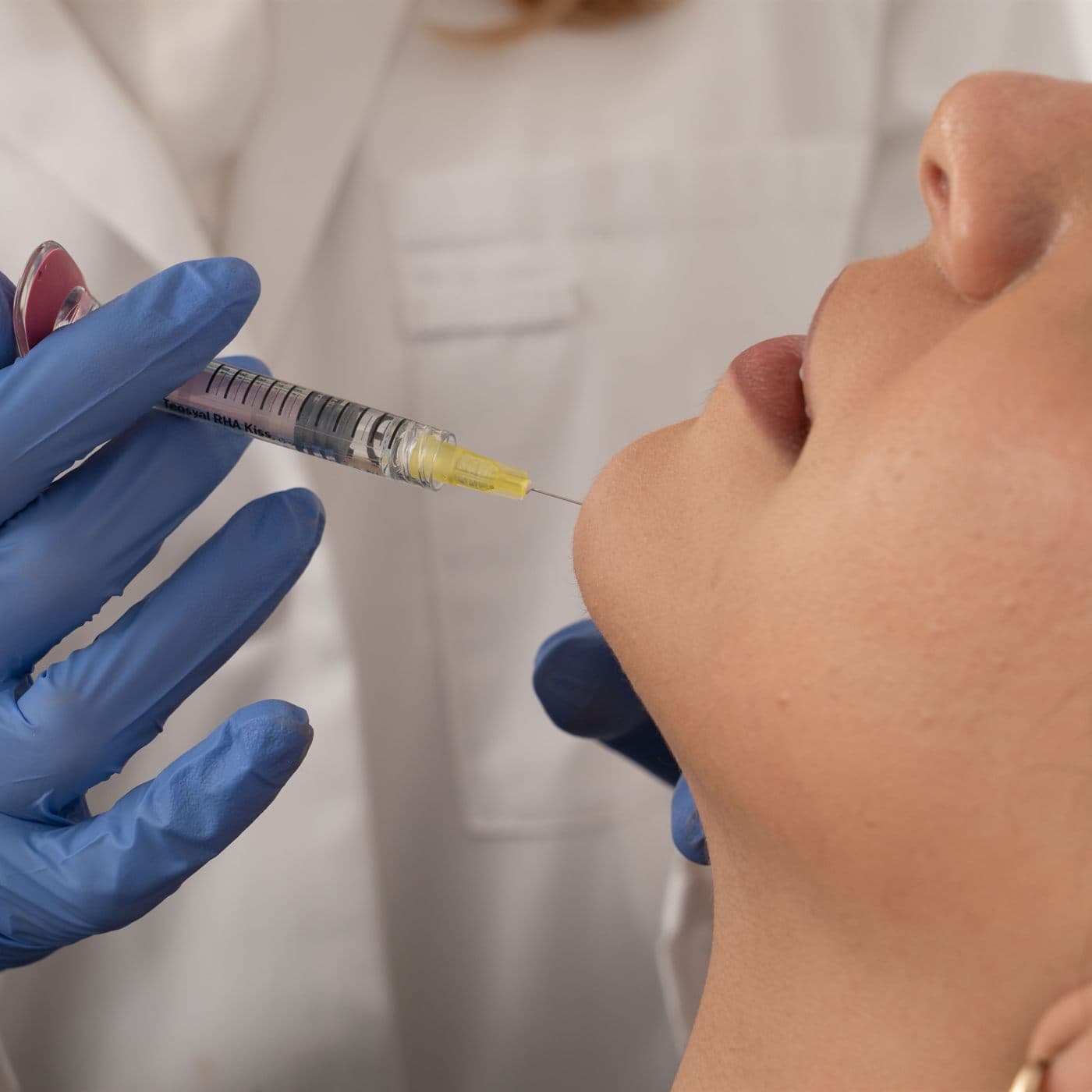 Lip Fillers